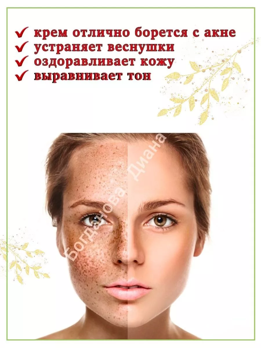 Крем от прыщей, акне, угревой сыпи Isme Acne Spots 10 гр