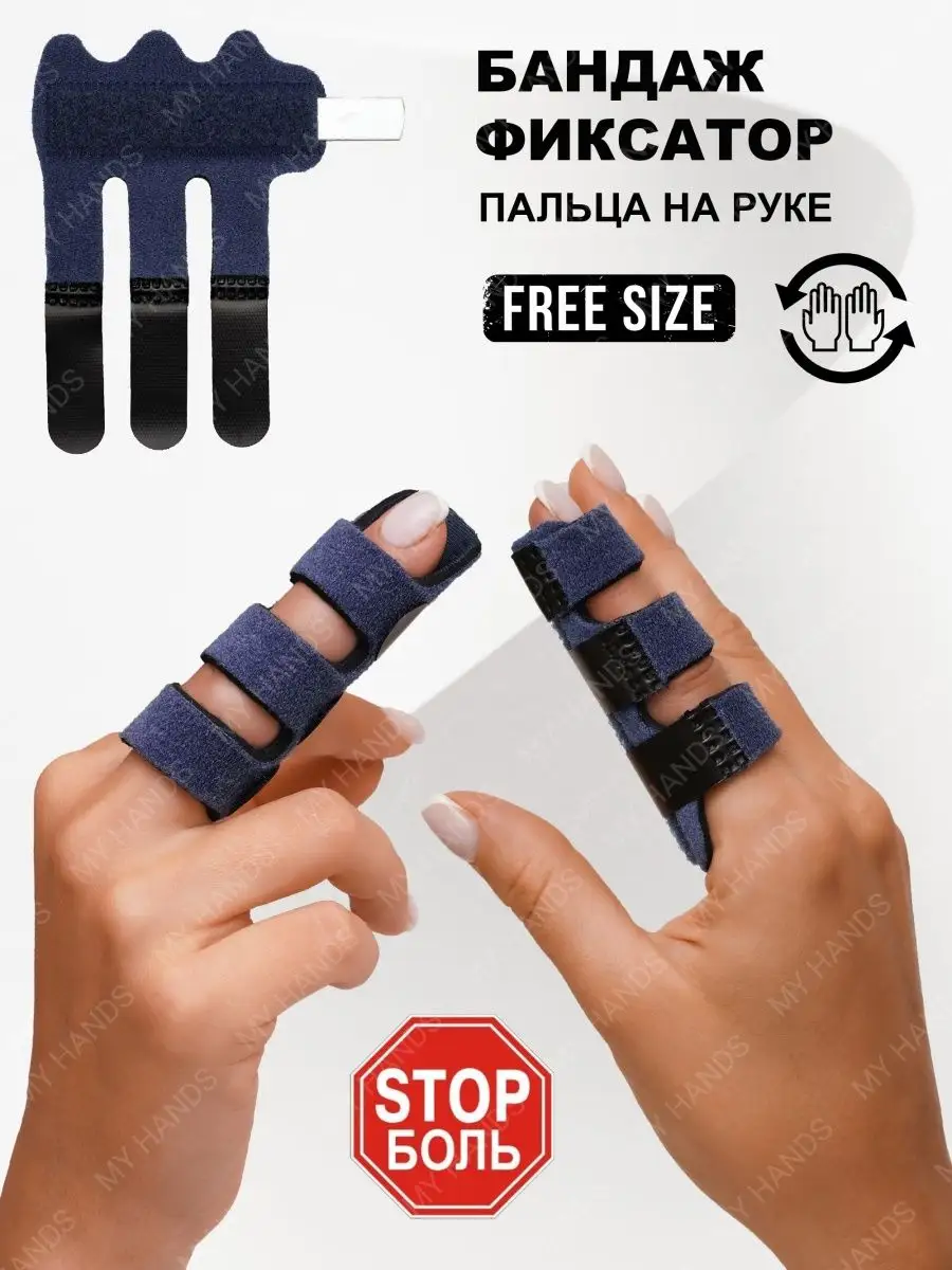 Лечение перелома пальца руки