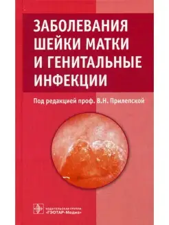 Под ред. Прилепской В.Н. Заболевания шейки матки и генитальн…