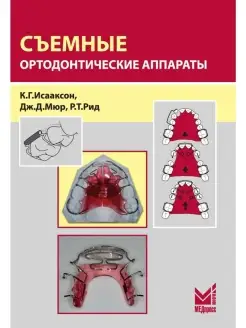 Съемные ортодонтические аппараты