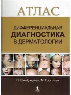 Дифференциальная диагностика