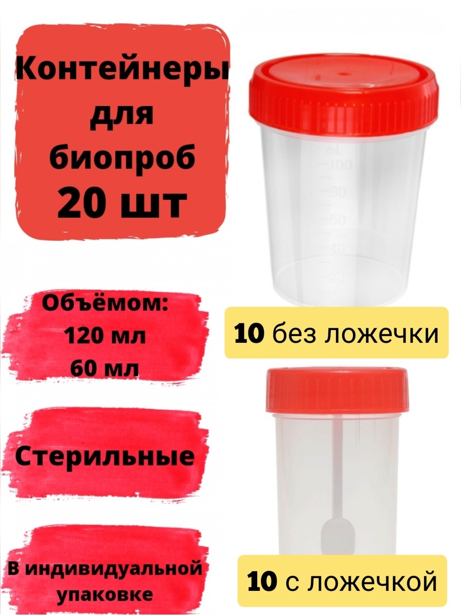 Баночка для сдачи анализов. Контейнер для кала. Баночка для анализов. Контейнер для анализов мочи. Баночка для сбора мочи.